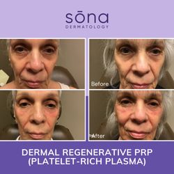 Sona Dermatology of Greensboro