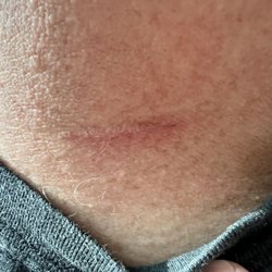 Palmetto Barbershop - Huge scratch left by one of the stylists/barbers (plus she does a consistently sloppy job each time)