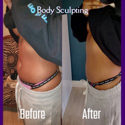 A Body By Design - Cavitation Ultrasound Body Sculpting, Radio Frequency, and Lymphatic Drainage