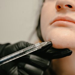 Chin Filler