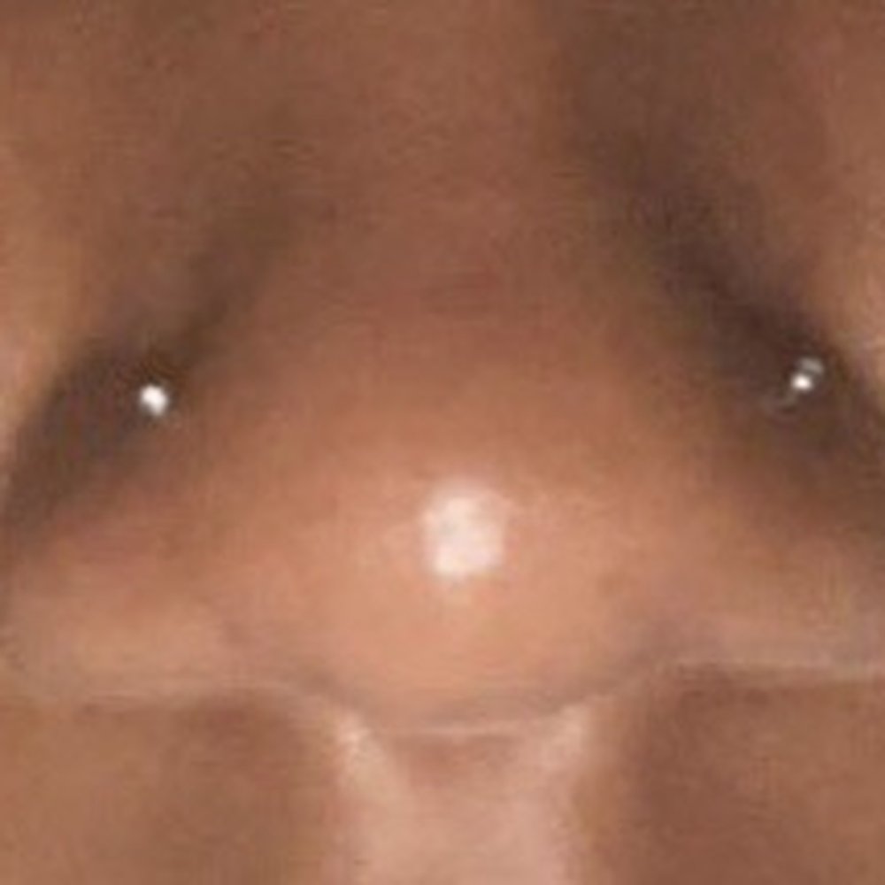 My crooked ass piercing. The one on the left is the one i received from here and as you can see it is NOT matched up with my other side.