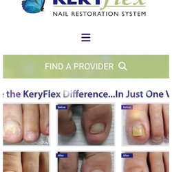 Northern Virginia Foot and Ankle Associates - KeriFlex product