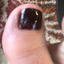 Messed up pedicure that didn't get fixed Messed up pedicure that didn't get fixed
