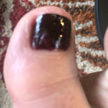 Templeton Nails & Spa - Messed up pedicure that didn't get fixed - Nail Salons Near Me - Templeton, California Templeton Nails & Spa - Messed up pedicure that didn't get fixed - Nail Salons Near Me - Templeton, California
