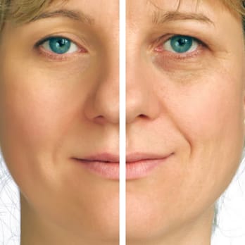 Supreme Skin - After & Before Results - Skin Care Near Me - Asheville, North Carolina Supreme Skin - After & Before Results - Skin Care Near Me - Asheville, North Carolina