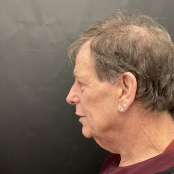 The Ferguson Clinic - Major turkey neck issues and a face that would stop a clock - Cosmetic Surgeons Near Me - Honolulu, Hawaii The Ferguson Clinic - Major turkey neck issues and a face that would stop a clock - Cosmetic Surgeons Near Me - Honolulu, Hawaii