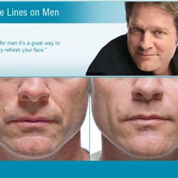 Dermaskin Clinic - Manchester - Radiesse Manchester