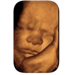 Imaging Miracles - So crabby! 
Call us at 417-861-0071 so we can see your little bundle of joy! 
www.imagingmiracles.life