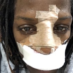 Francis J Collini, MD FACS - The Renaissance Center - Dc did a real good job on me my noise looks great thx dc much love
