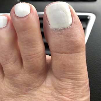 MILI NAIL - My toes look so bad - Nail Salons Near Me - Mililani, Hawaii MILI NAIL - My toes look so bad - Nail Salons Near Me - Mililani, Hawaii
