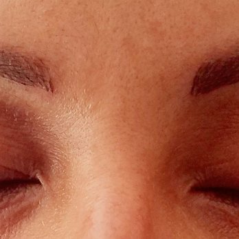 Dmara Skinspa - After the procedure - Skin Care Near Me - New York, New York Dmara Skinspa - After the procedure - Skin Care Near Me - New York, New York