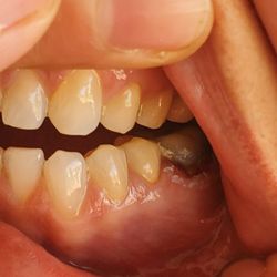 Desert Valley Dental