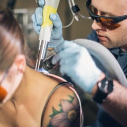 Out of Ink Laser Tattoo Removal