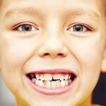 Neighborhood Dentistry - Pediatric Dentists Near Me - Salem, Oregon Neighborhood Dentistry - Pediatric Dentists Near Me - Salem, Oregon
