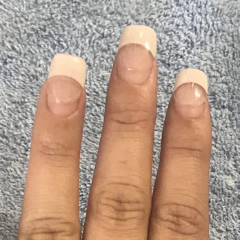 Miracle Nails - Before. Had my nails butchered by some incompetent person. I was horrified! - Nail Salons Near Me - San Antonio, Texas Miracle Nails - Before. Had my nails butchered by some incompetent person. I was horrified! - Nail Salons Near Me - San Antonio, Texas