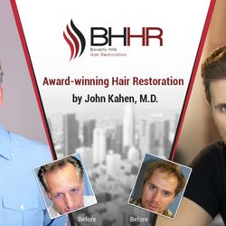 Beverly Hills Hair Restoration - Actual results with real patients! Call us for a free consultation.