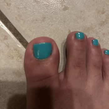 Forum Nails & Spa - The big toe is swollen - Nail Salons Near Me - Fresno, California