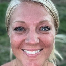 Concierge Injectables - AFTER - 2 weeks after Botox injections to forehead, frown lines, and crows feet.