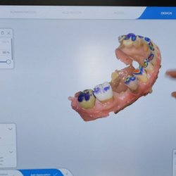 3D scan results