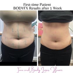 Face & Body Laser Hawaii - Body Fx (Laser fat reduction and body sculpting)
