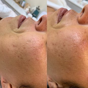 By Nikolle - Deep Pore Cleansing Facial - Eyebrow Services Near Me - Honolulu, Hawaii By Nikolle - Deep Pore Cleansing Facial - Eyebrow Services Near Me - Honolulu, Hawaii