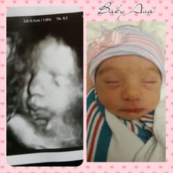 First Glimpse Imaging