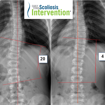 Lancaster Spinal Health Center LLC - Chiropractors Near Me - Lititz, Pennsylvania Lancaster Spinal Health Center LLC - Chiropractors Near Me - Lititz, Pennsylvania