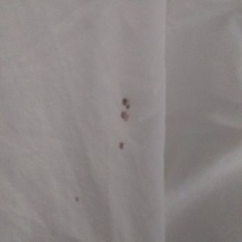 Quality Inn - Bedbugs and my blood - Hotels Near Me - Hartsville, South Carolina Quality Inn - Bedbugs and my blood - Hotels Near Me - Hartsville, South Carolina
