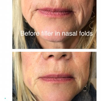 Daniela Beauty Nurse - Skin Care Near Me Daniela Beauty Nurse - Skin Care Near Me