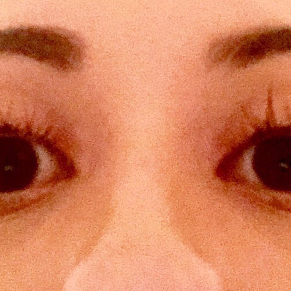 My Chick Habit - 5 days post fill with Kaitlyn. Terrible quality work, natural lash broken off in large gaps and clusters. - Eyelash Service Near Me - Long Beach, California My Chick Habit - 5 days post fill with Kaitlyn. Terrible quality work, natural lash broken off in large gaps and clusters. - Eyelash Service Near Me - Long Beach, California