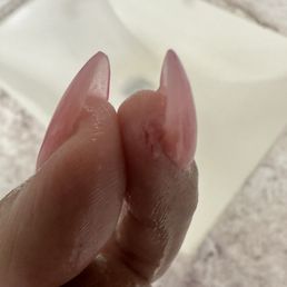 injured finger