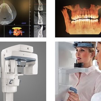 Howe Dental Associates - At Howe Dental Associates we always strive to make sure our patients are treated with the best and newest technology. - Cone Beam - General Dentistry Near Me - Passaic, New Jersey Howe Dental Associates - At Howe Dental Associates we always strive to make sure our patients are treated with the best and newest technology. - Cone Beam - General Dentistry Near Me - Passaic, New Jersey