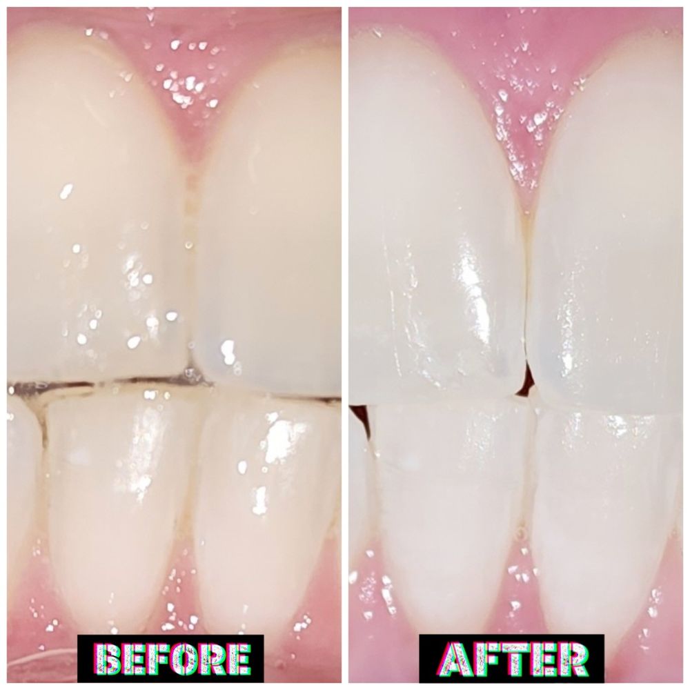 Mr. Glowman Teeth Illumination Logo