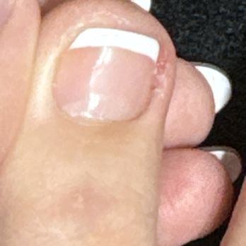 Sheldon Nails - How they left my toe... - Waxing Near Me - Channelview, Texas Sheldon Nails - How they left my toe... - Waxing Near Me - Channelview, Texas