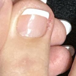 Sheldon Nails - How they left my toe...