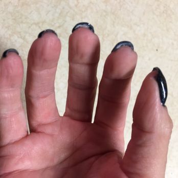 Pink Nails & Spa - Thick, goopy and coated under the nails. - Nail Salons Near Me - Port St Lucie, Florida Pink Nails & Spa - Thick, goopy and coated under the nails. - Nail Salons Near Me - Port St Lucie, Florida