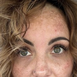 Amazing Lash Studio Surprise - Front view can't really tell the difference obviously my hair is in the way, but it bothers me still