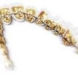 Rice Orthodontics - Incognito hidden braces!