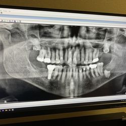 Winton Adam J DDS MD PA - Is this scary or what? Panorex