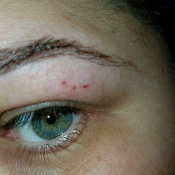 Today Nail Spa - Swollen and sore from the wax job I got - Nail Salons Near Me - Fairview Heights, Illinois Today Nail Spa - Swollen and sore from the wax job I got - Nail Salons Near Me - Fairview Heights, Illinois