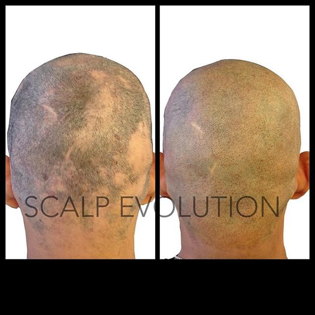 Scalp Evolution Logo