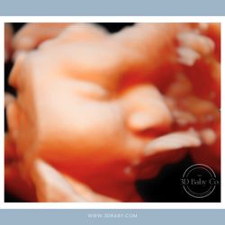The 3D Baby Co. - The cutest little side profile!
(3rd trimester 3D ultrasound)