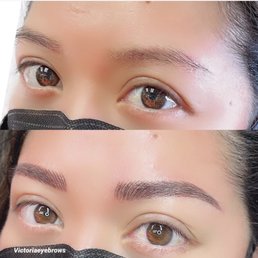 Before and After