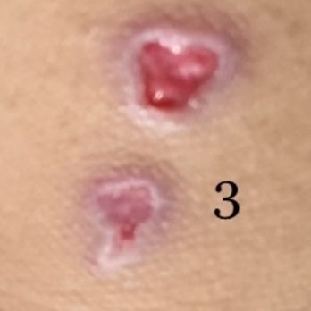 Inkspot Tattoo's - 2 days after #2 - Tattoo Near Me - Fontana, California Inkspot Tattoo's - 2 days after #2 - Tattoo Near Me - Fontana, California