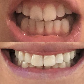 Lineberry Dental - General Dentistry Near Me - Cocoa Beach, Florida Lineberry Dental - General Dentistry Near Me - Cocoa Beach, Florida