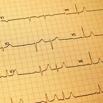 Blue Coast Cardiology - Cardiologists Near Me - El Centro, California Blue Coast Cardiology - Cardiologists Near Me - El Centro, California