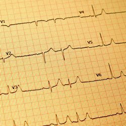 Blue Coast Cardiology