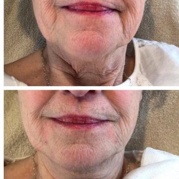 Flawless Face Aesthetics - Medical Spas Near Me - Milwaukee, Wisconsin Flawless Face Aesthetics - Medical Spas Near Me - Milwaukee, Wisconsin