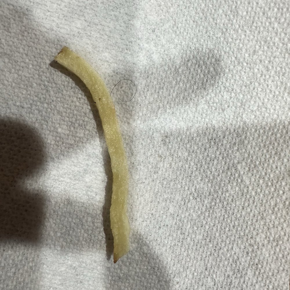 Hair found in my fries Hair found in my fries