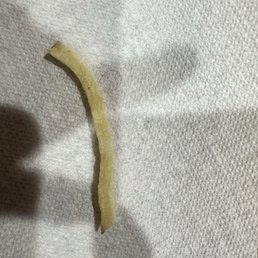 Hair found in my fries